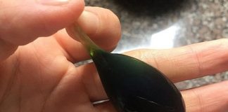 Ăn mật cá trắm: hai người bị suy gan, suy thận